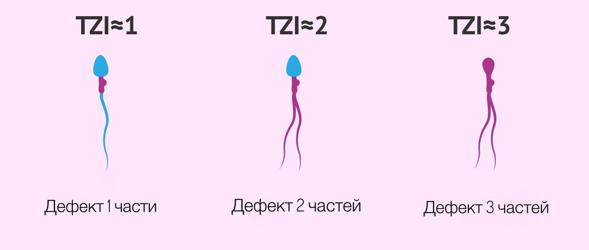 Мечты о детях: как «киллеры» сперматозоидов влияют на вероятность зачатия