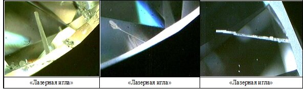 Пример отчистки бриллианта лазерным сверлением до применения КМ.