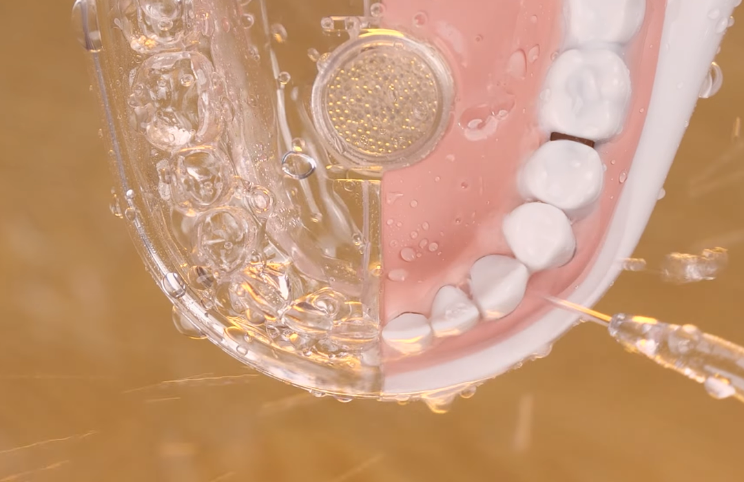 Сила напора в портативных ирригаторах может не отличаться от таковой у стационарных приборов. Фото: https://youtu.be/Yo-ZovuIkGs