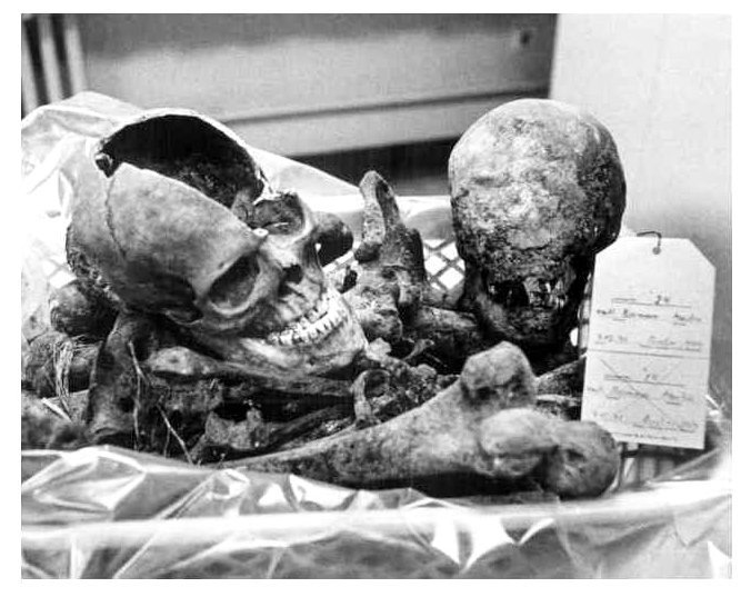 Останки Мартина Бормана и Людвига Штумпфеггера. Оба скончались 2 мая 1945 года, в обоих черепах были найдены осколки стекол от капсул с цианистым калием