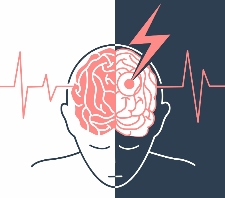 Режим инсульта