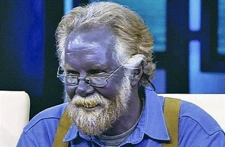 Пол Карасон, применял коллоидное серебро больше 15 лет. 