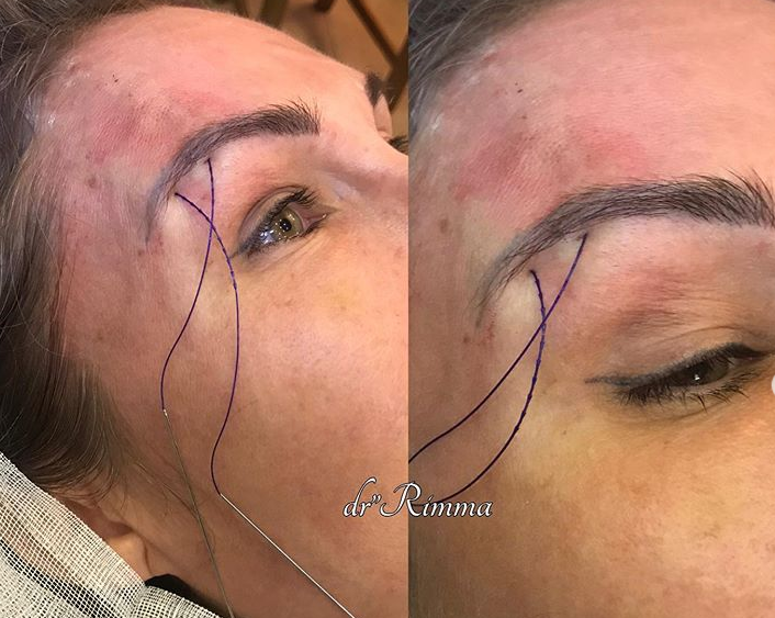 источник фото Instagram:  dr.useeva_rimma