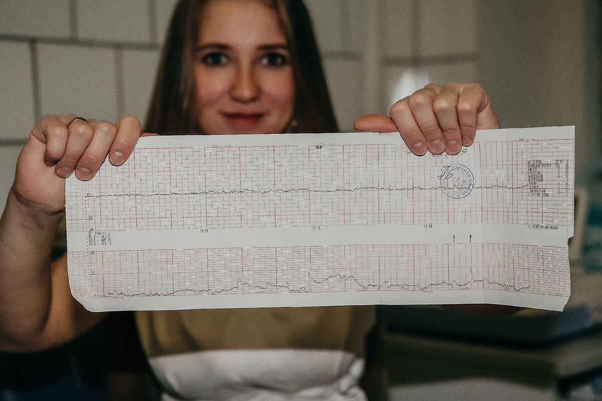 На фото КТГ не очень. Женщину мы госпитализировали, она уже родила и всё у них с малышом хорошо!;)