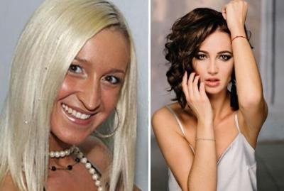 До и после пластики Ольга Бузова, певица