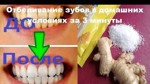 ✔️Как ОТБЕЛИТЬ желтые зубы👍100% результат!!!РЕЦЕПТ ОТБЕЛИВАНИЕ ЗУБОВ в Домашних Условиях за 3 минуты