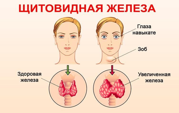 фото источник medboli.ru