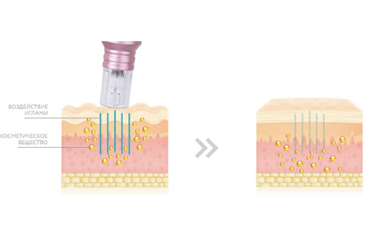 Воздействие на кожу …