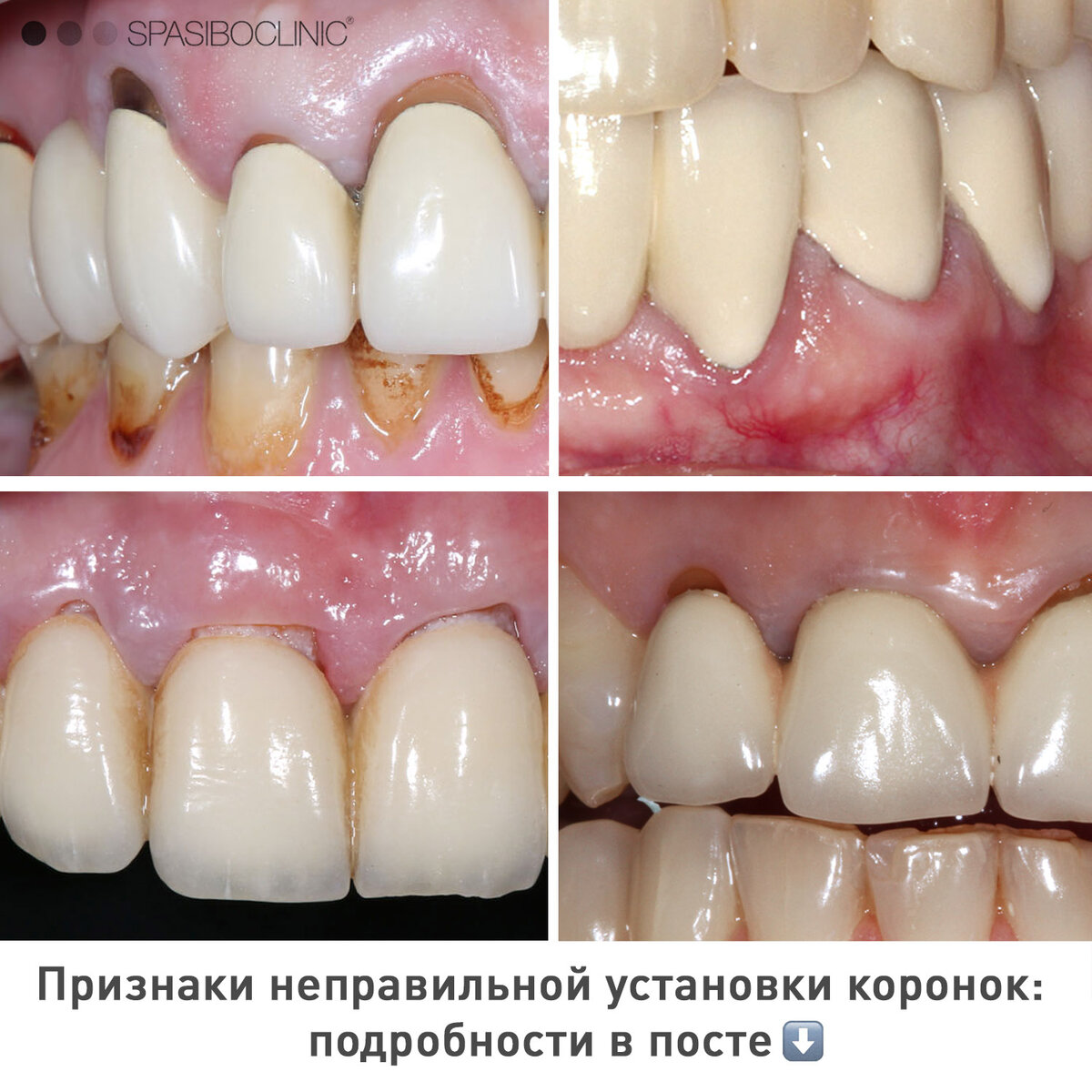 Запах из под коронки