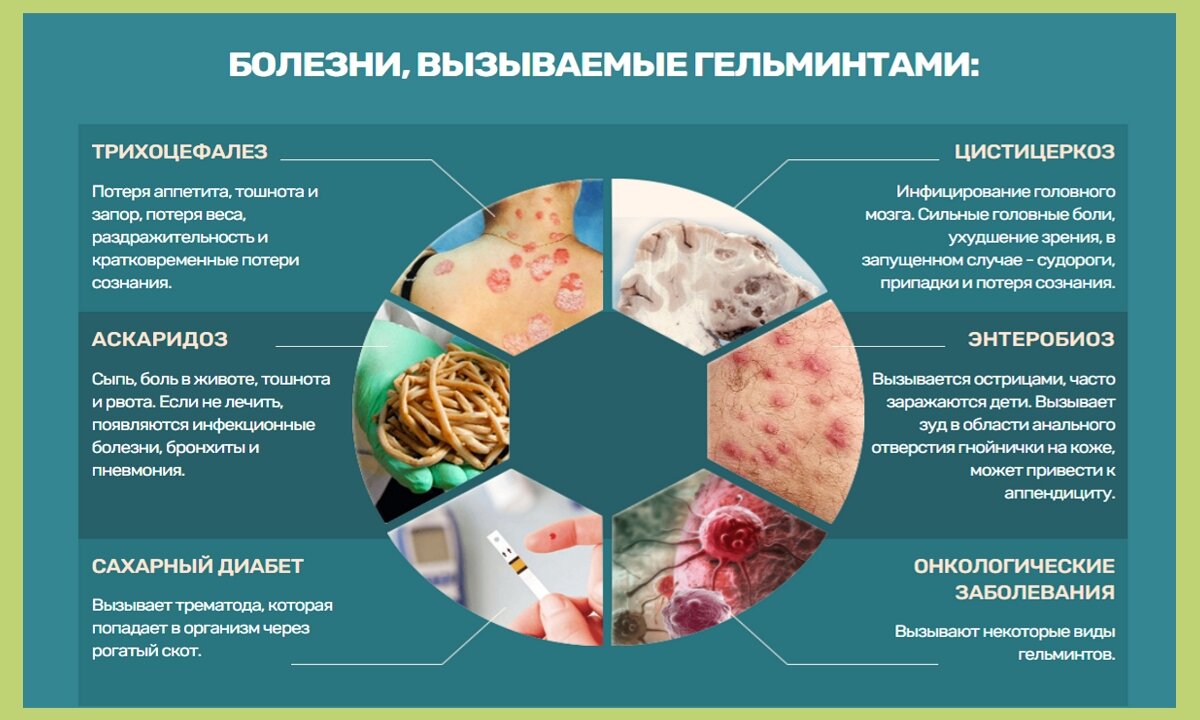 Паразитарные инфекции симптомы