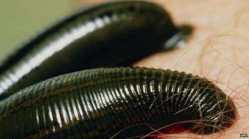 2. Биоферма пиявок в городе Суонси (Swansea Biopharm Leech Farm), Уэльс

Вы думали, что торговля пиявками вымрет с появлением современной медицины, не так ли? В некоторых отношениях это так и есть. Тем не менее, в Уэльсе есть ферма, которая считает, что время использования пиявок вернётся из-за их медицинской пользы. 
