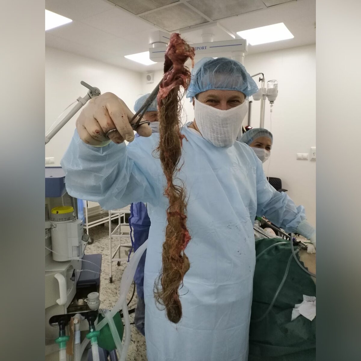 Дермоид каков он  есть. Источник: vk.com/cmdmo_k