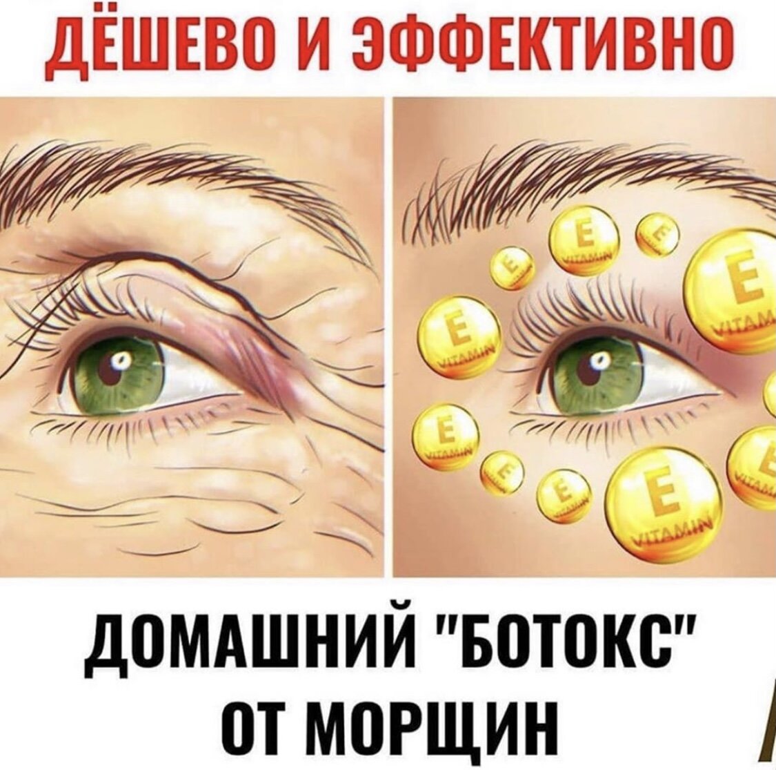 Желаете, чтобы кожа лица была эластичной, гладкой и подтянутой ? Вам в помощь крахмал. Этот ингредиент – натуральный ботокс. Он омолодит, устранит морщины и выровняет цвет. 
‼️Вам понадобится:

🔹крахмал (картофельный или кукурузный) – 1 ст. л. с горкой. 

🔹вода – 150 мл.
.
🔹Можно добавить 1 капсулу витамина аевит ( проколоть и выдавить)- при сухом типе кожи 

⬇️Приготовление и применение маски⬇️:

▪️Растворите крахмал в 100 мл холодной воды.

▪️Оставшуюся воду, 50 мл, доведите до кипения.

▪️Влейте крахмальный раствор в кипящую воду.

▪️Мешайте смесь, пока не загустеет, в это время слегка кипит.
.
▪️Когда загустеет, снимаем с плиты, остывает до температуры тела, раствор тёплый должен быть , после этого Добавить витамин аевит, проколоть драже и выжить, размешать и нанести кистью на кожу лица, шеи, зону декольте. 
.
❗ Холоднуб маску нет смысла наносить, надо тёплую, она быстро остывает на коже и становится как маска. 

💁‍♀️А вы знаете, что крахмал содержит витамины Е, С, В1, В5, В6, холин, железо и калий. Благодаря этим веществам крахмальную маску применяют также как увлажняющее, противовоспалительное и очищающее средство.

.🔹МАСКУ наносить 
на лицо, включая область вокруг глаз и рта. Вы также можете распределить ее по шее и зоне декольте. Подождите 20 минут, а остатки смойте теплой водой. Лучше делать в горизонтальном положение, надо лечь и не разговаривать.
.
Смыть тёплой водой с помощью спонжа или ватного диска и нанести крем. 
.
Не раз приходилось слышать, что покупать дорогую косметику стоит, ведь она, и правда, работает. Вот только на такие покупки не всегда хватает денег, тем более, если одним кремом не обойтись. Поэтому этот рецепт маски из крахмала станет вашим верным помощником.
.
.
Маска из крахмала от морщин вместо ботокса начинает работать после 2-3-го применения. Повторяйте процедуру нанесения 1раз в неделю на регулярной основе.
.
Отлично дополняет другие техники, такие как массаж гимнастика для лица.
.
Будьте красивыми 🌹