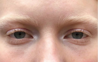 Не в бровь, а в глаз. В моде - блонд. https://www.instagram.com/jennycoombsmakeup/