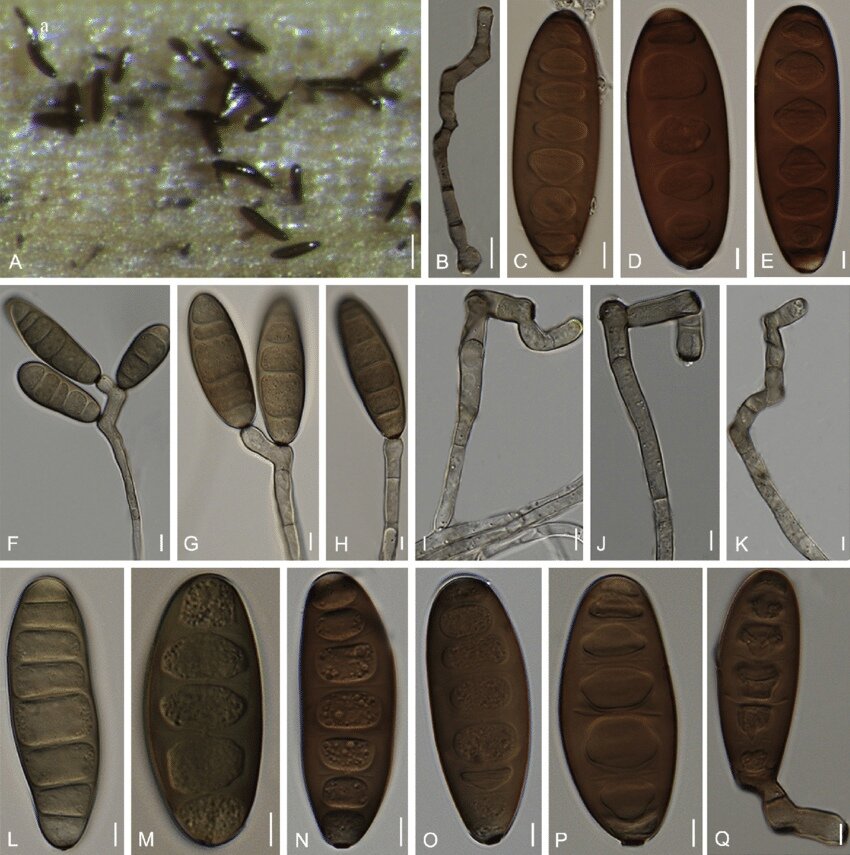 Dimuthu S Manamgoda. The genus Bipolaris (November 2014) Studies in Mycology. University of Sri Jayewardenepura 
Конидии гриба под микроскопом