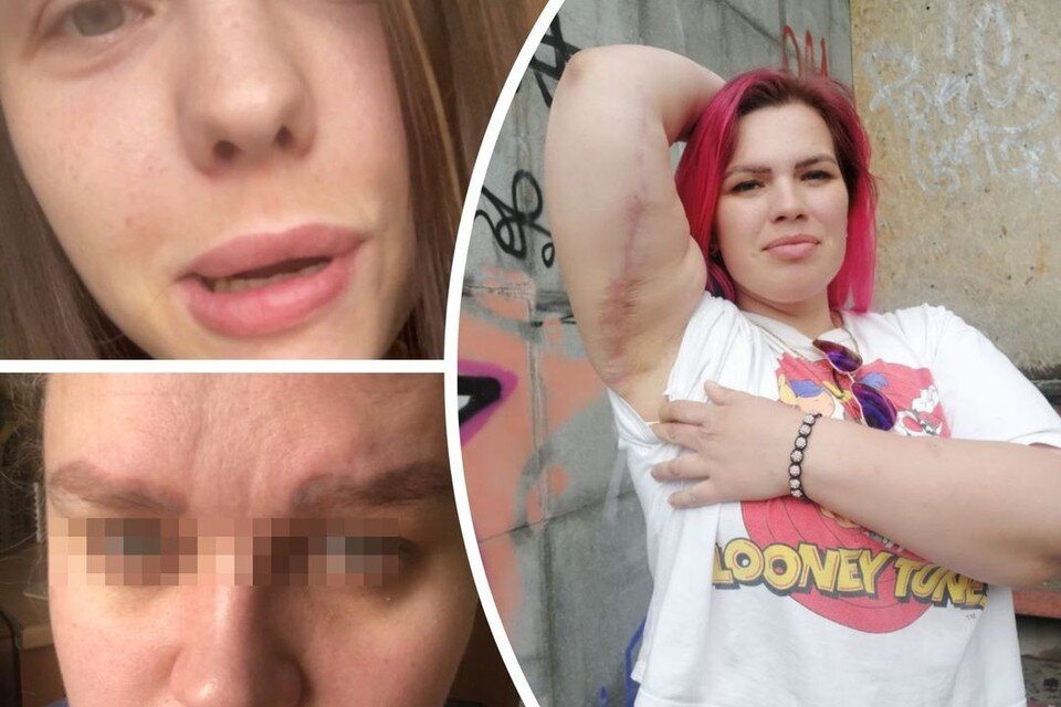    Сибирячки часто становятся жертвами неудачных бьюти-процедур. Фото: предоставлено Еленой/Анна ПАШАГИНА/предоставлено Ольгой