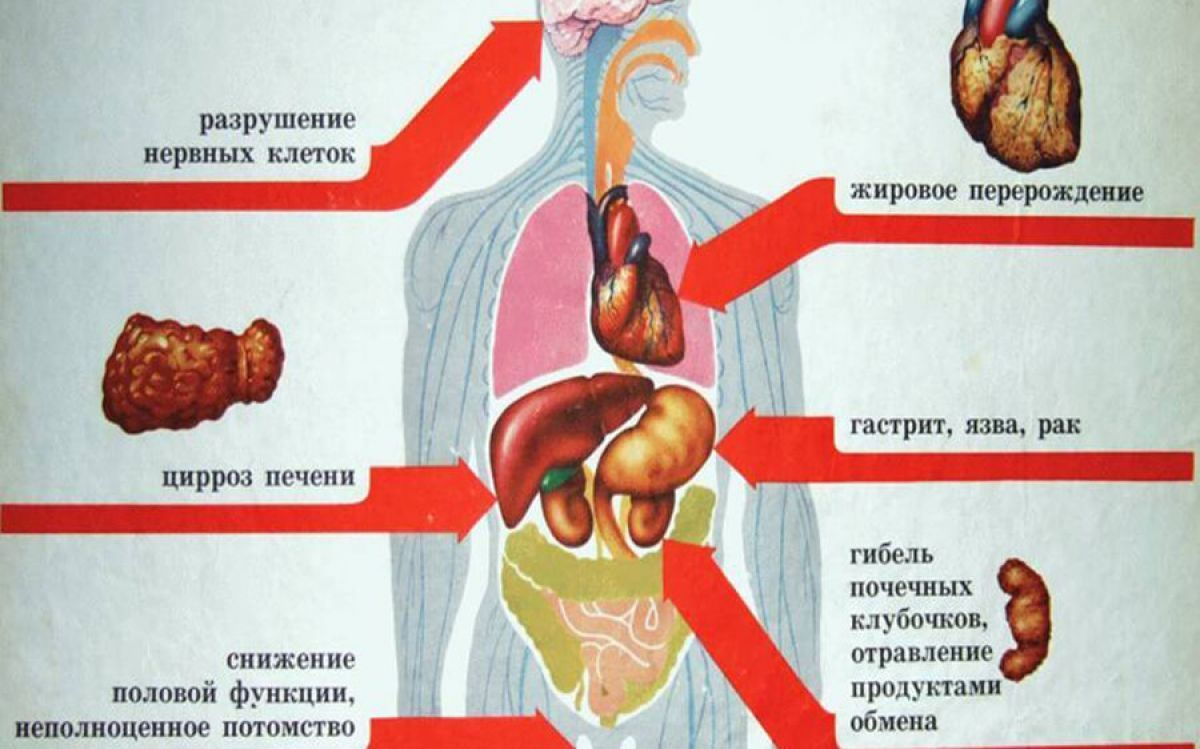 Орган вреда. Вред алкоголя. Влияние алкоголя на организм. Воздействие алкоголя на организм человека. Последствия влияния алкоголя.