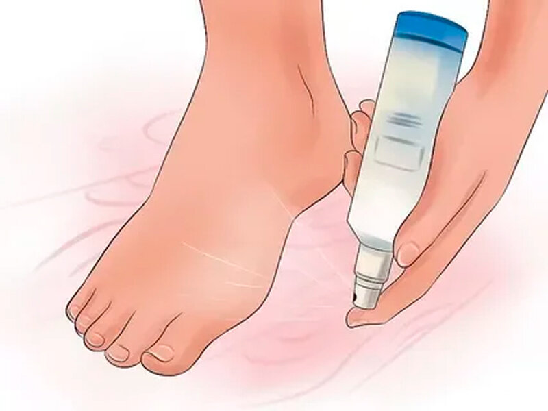 Причины и способы избавления от запаха ногтей на ногах