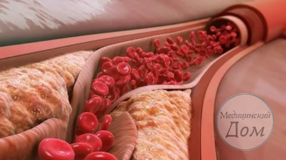 Поставь лайк и подпишись на канал, если тебе интересно здоровье и все, что с ним связано😉