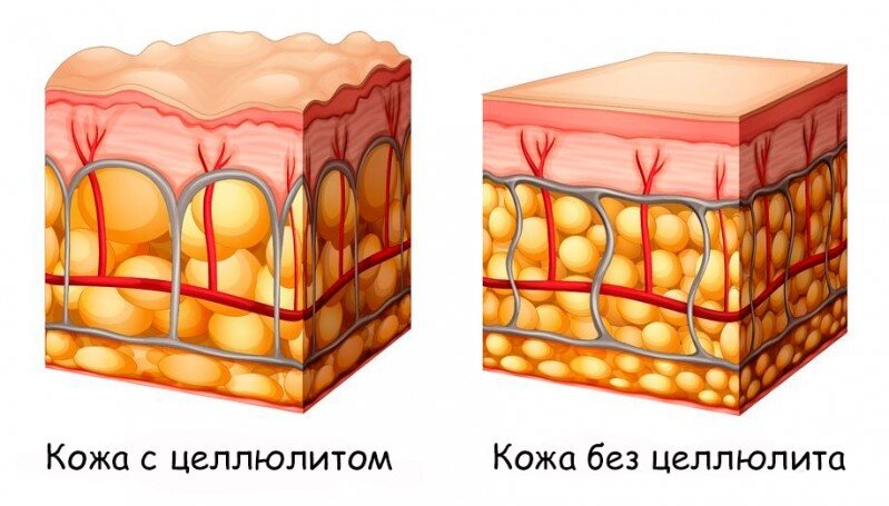 Баночный массаж - Медицинское объединение 