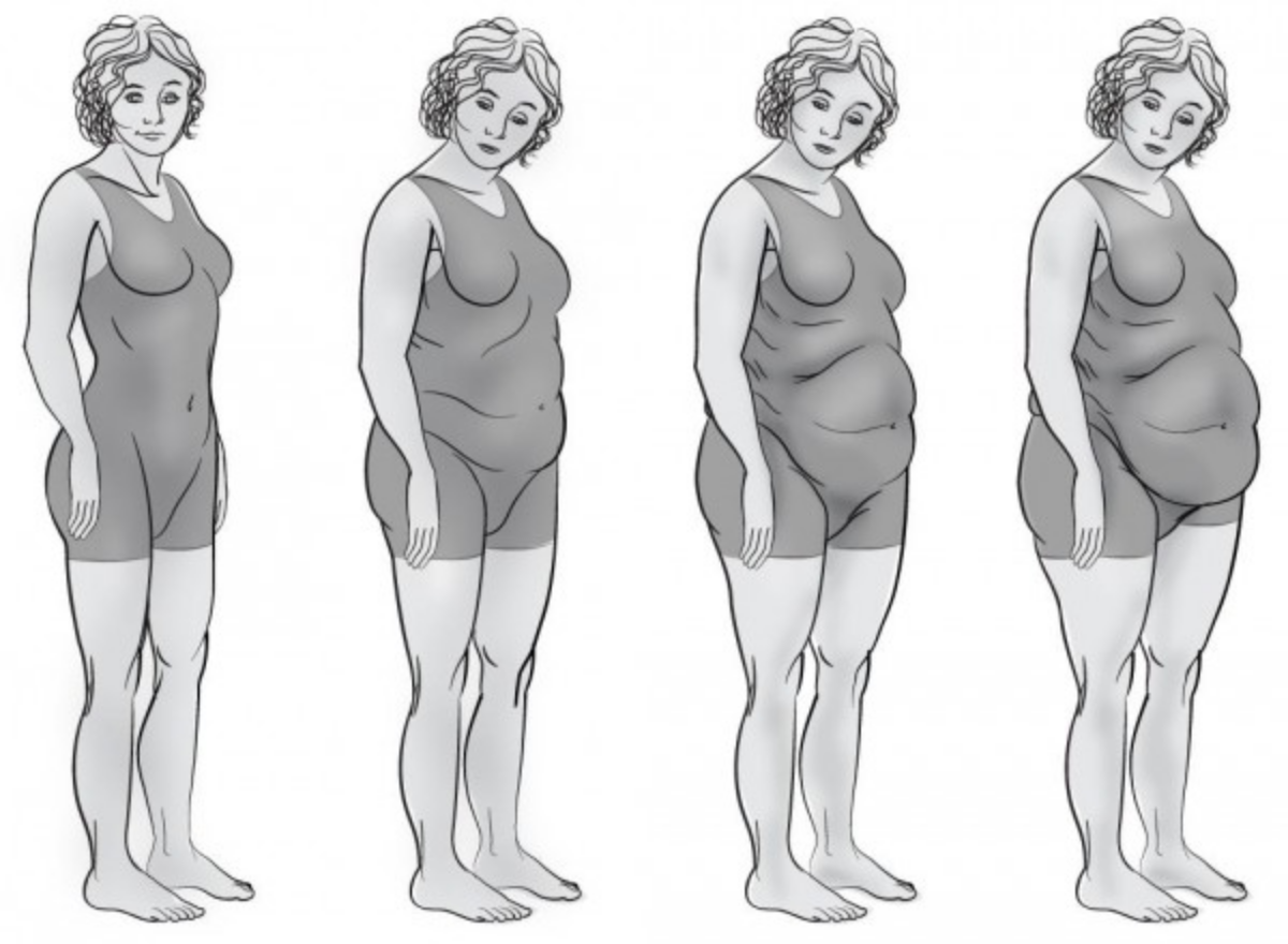 Почему с возрастом вес. Ожирение по типу фигуры. Изменение фигуры с возрастом. Типы ожирения у женщин. Возрастные изменения женского тела.