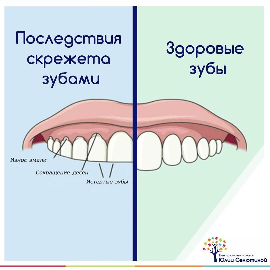 Стучать зубами причины