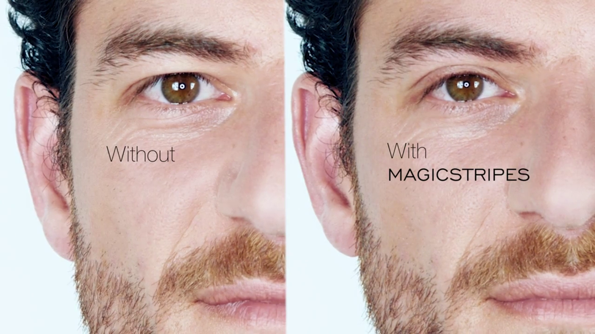 До и после использования лент для подтяжки век