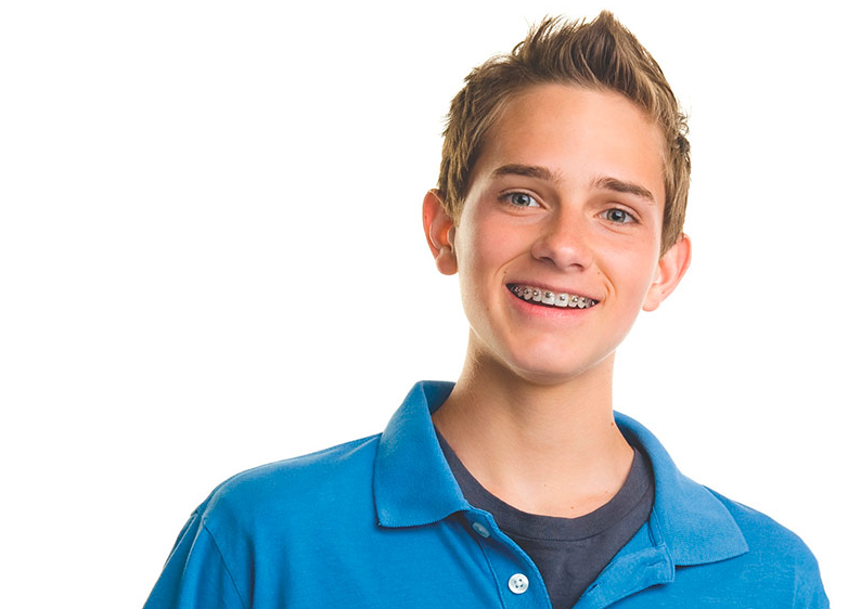 Брекеты Damon Q. Фото Ormco Corporation