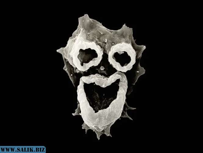 Природе не откажешь в чувстве юмора: мозговой паразит *улыбается* нам фирменной улыбкой Джокера.