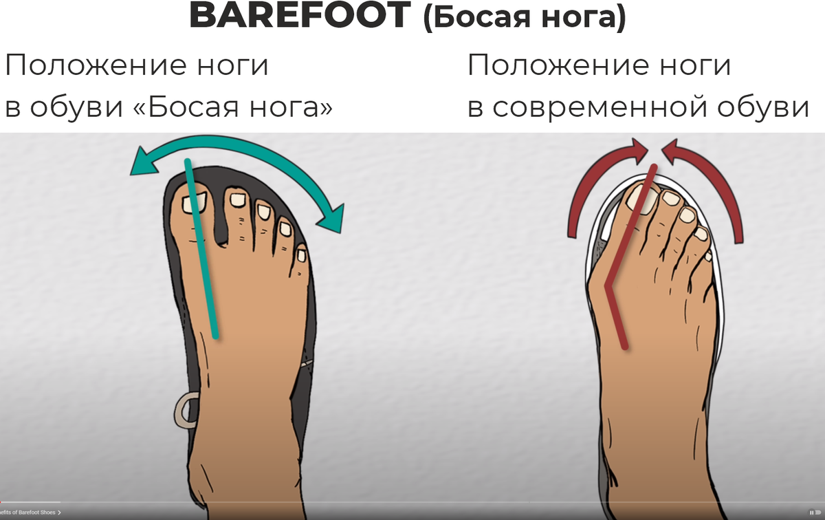 Естественное положение стопы в обуви «Босая нога», которая повторяет анатомическое строение носочной части ноги.