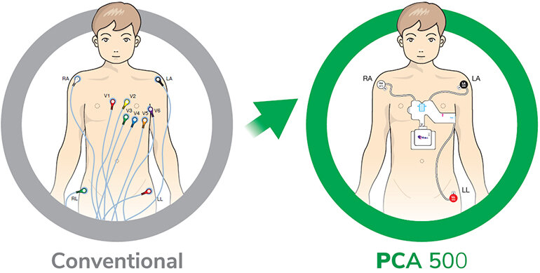 Сделать ЭКГ клинического качества у себя дома