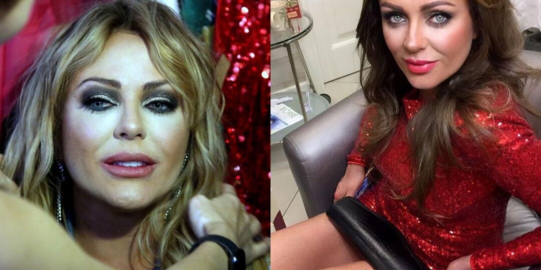 Юля Началова и ее пластические операции