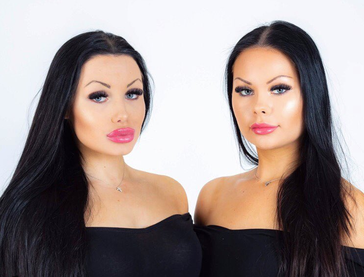 Обе девушки. Сестры веймар. Обе девушки. Девушки близнецы с большими губами. Дружба девушек.