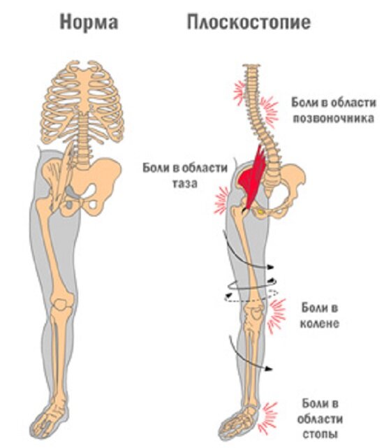 Фото с сайта https://nogi-help.ru