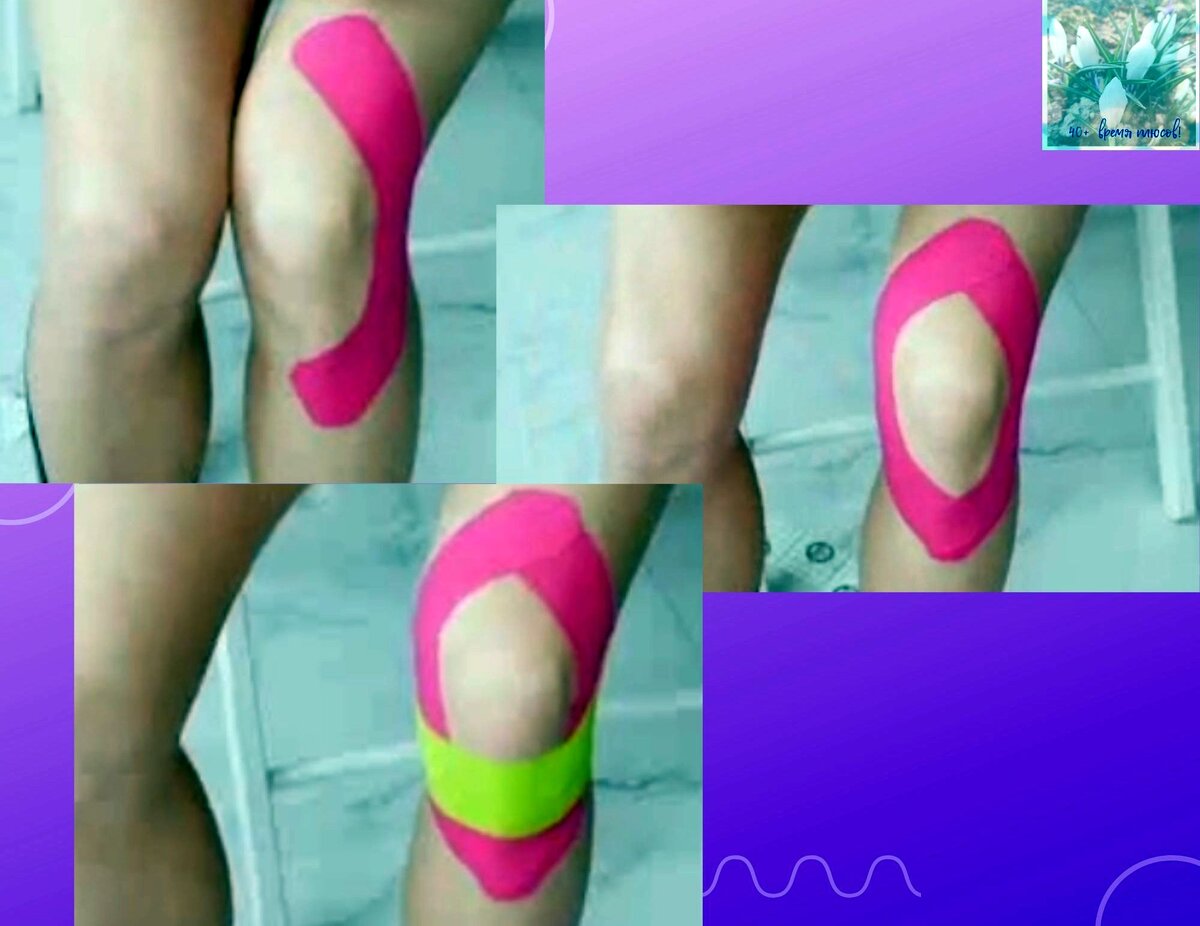 Фиксация сустава. Шаги раз,два, три... Работа с тейпами Ольга Енко