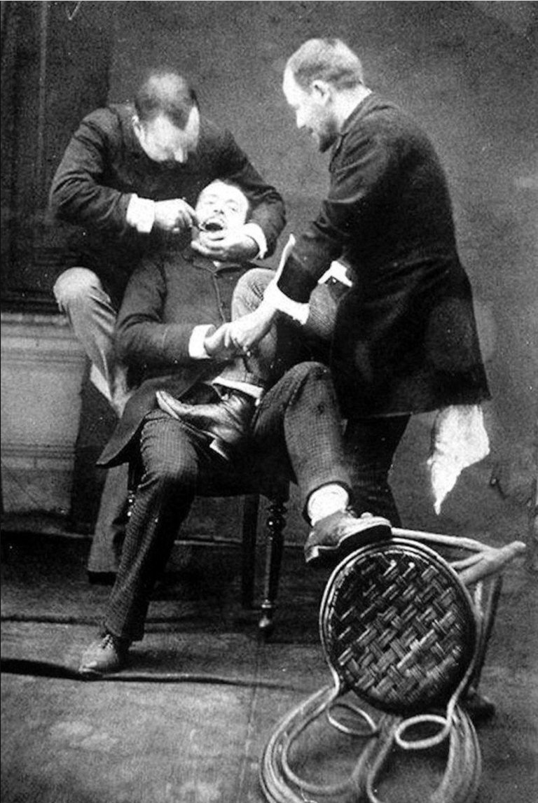 Стоматология в викторианской Англии. Фото: https://metro.co.uk