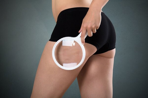 Схема улучшения кровообращения в ногах