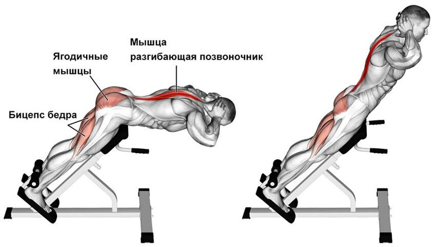 гиперэкстензия 