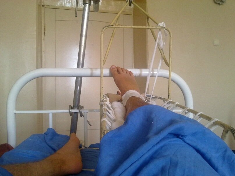 Выбор - месяц лежать в таком положении, или заплатить? 