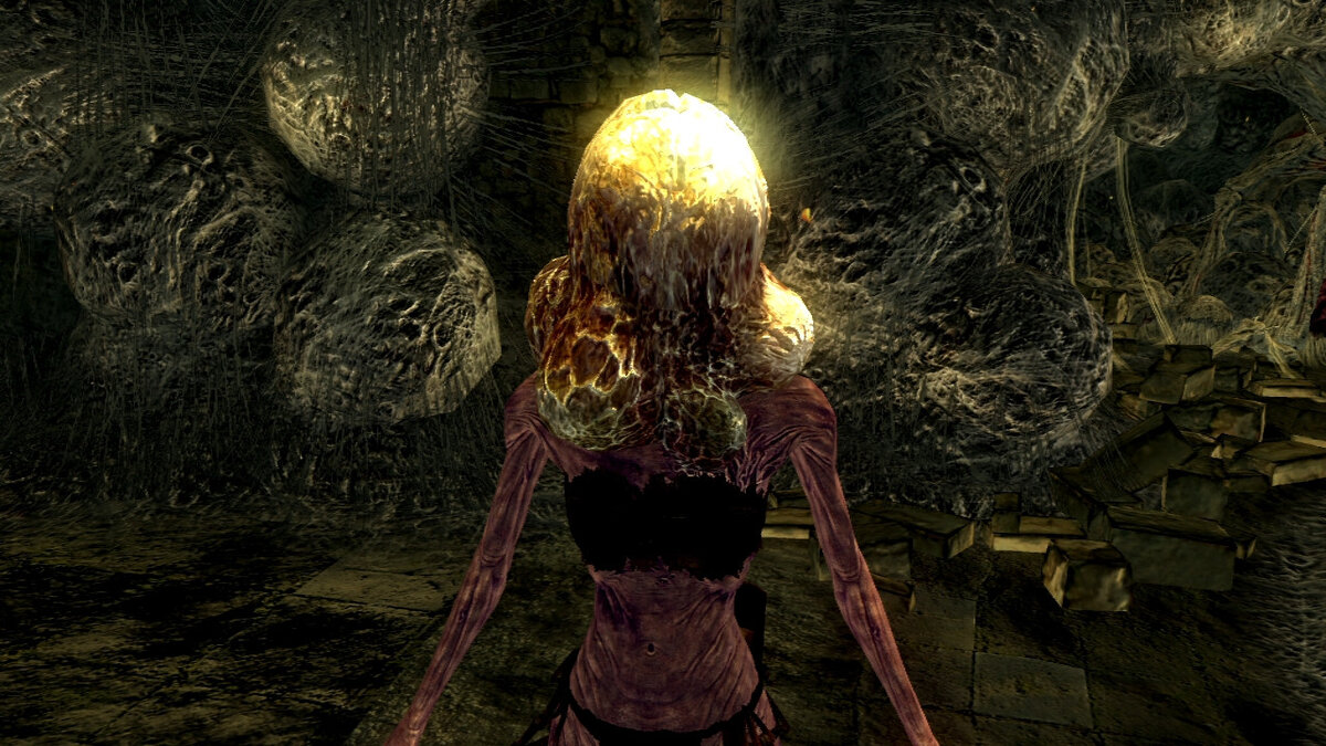 2-я стадия заражения; Голова ещё не имеет паразита, но уже четко видно яйцо.