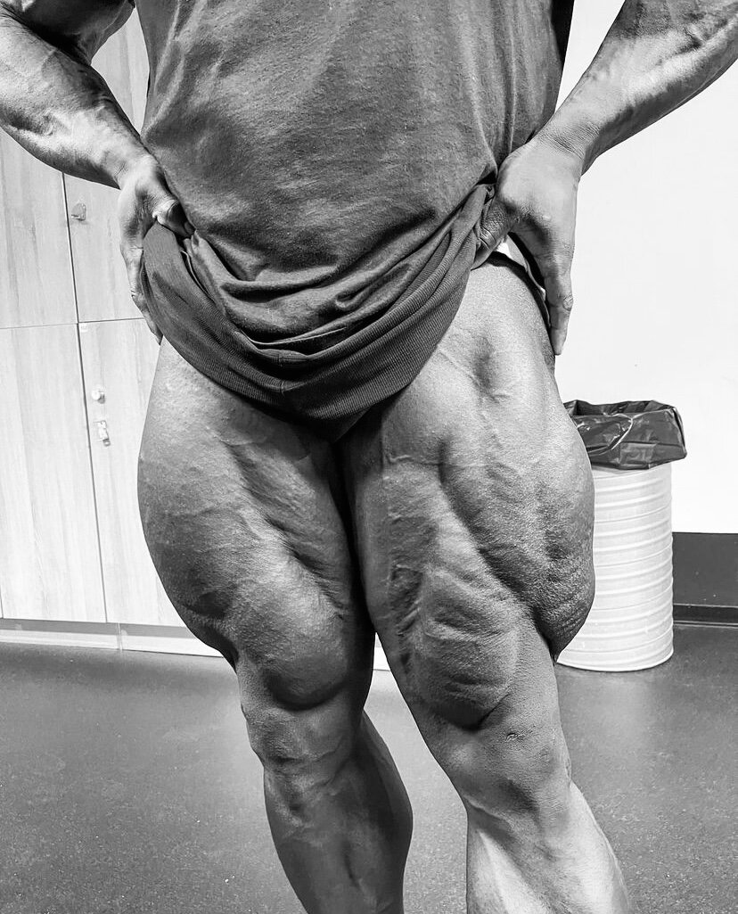 Одна из главных причин боли в суставах