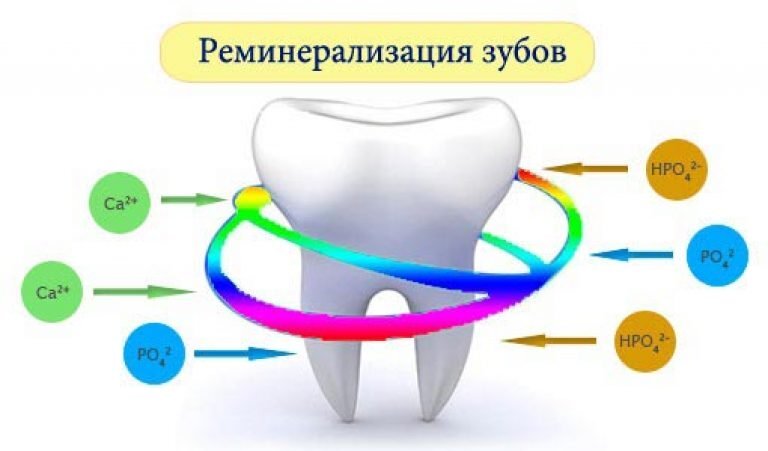 Разрушение эмали – это не миф. С ней в той или иной степени сталкивается практически каждый человек.-2