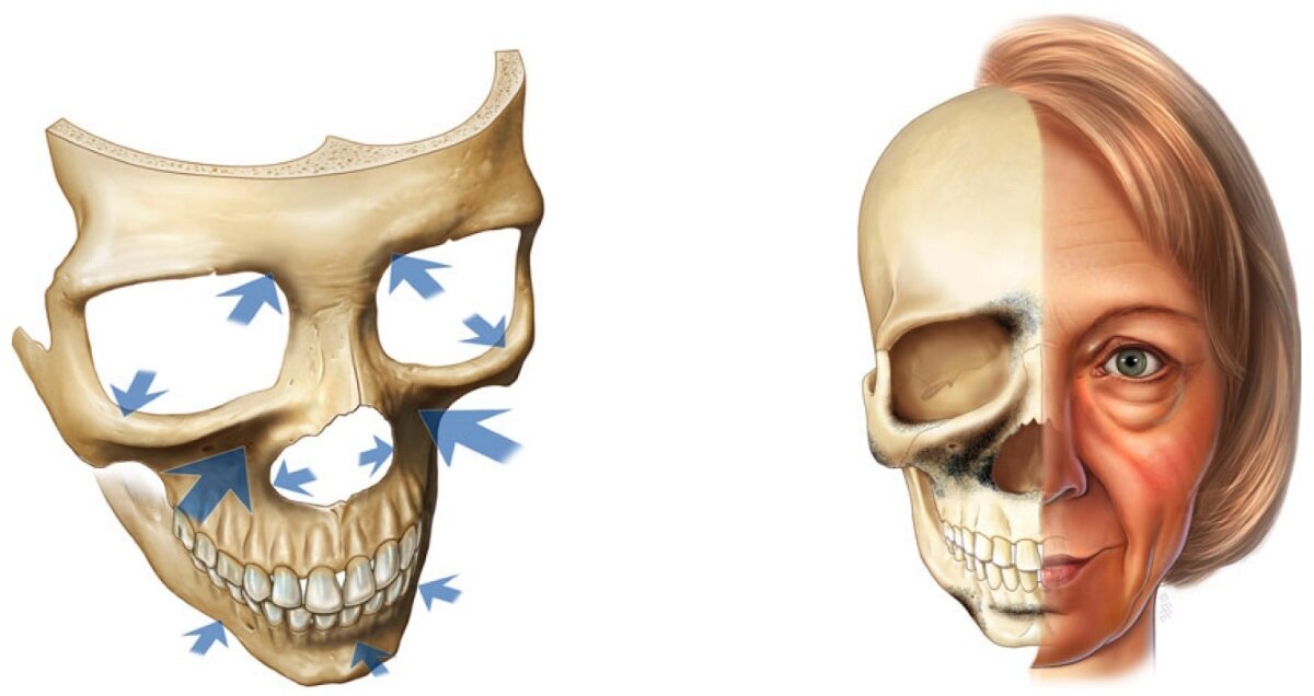Возрастное изменение костей лицевого черепа