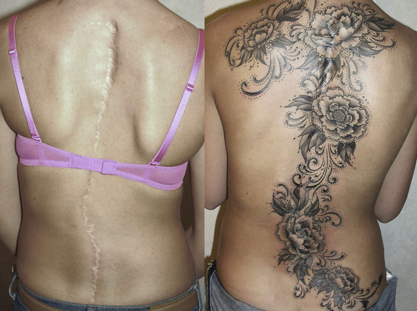 фото с сайта https://ratatum.com. Следы масштабного оперативного вмешательства в районе позвоночника искусно спрятаны не менее масштабной тату-работой.