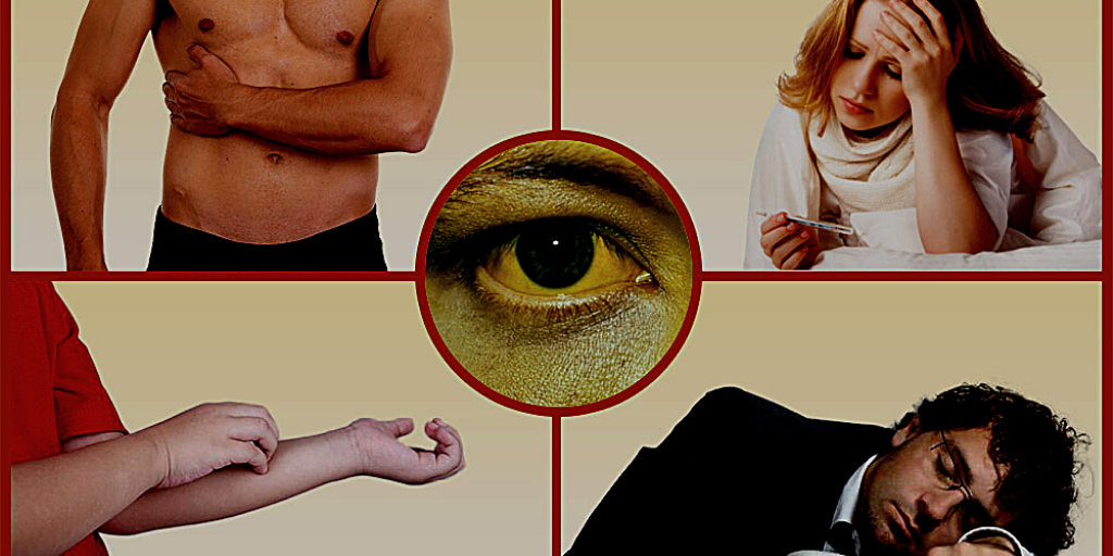 Симптомы нарушения  работы печени: патологическая усталость, желтые склеры, зуд, дискомфорт в правом подреберье, субфебрильная  температура при  вирусных гепатитах.