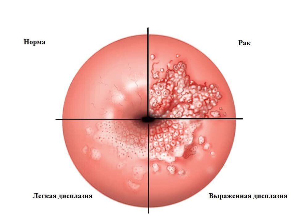 Признаки cin