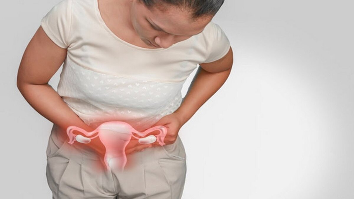 Сильное опущение матки. Опущение матки лечебная физкультура. Срединная кольпорафия (операция лефора-нейгебауэра). Недержание мочи и опущение матки. Опущение матки после родов.