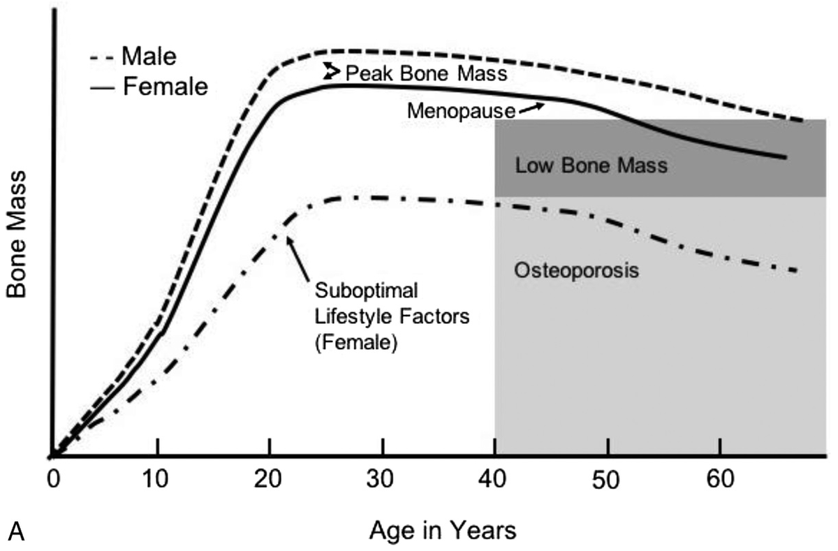 График изменения костной массы с возрастом (по оси Х - возраст, по оси Y - костная масса)