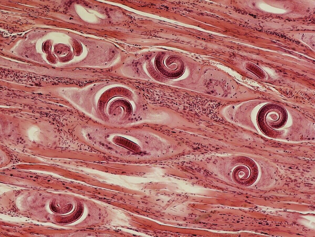 Личинки трихинелл в мышечной ткани. Изображения взяты из сервиса "Яндекс картинки"