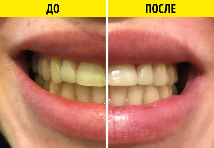 Фото до и после